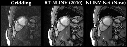 An MRI image of a heart.