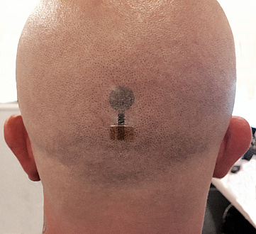 Bald back of the head with tattoo electrodes for EEG measurement