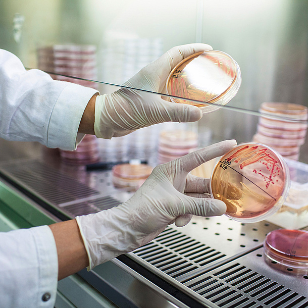 Two petri dishes with reddish substances.