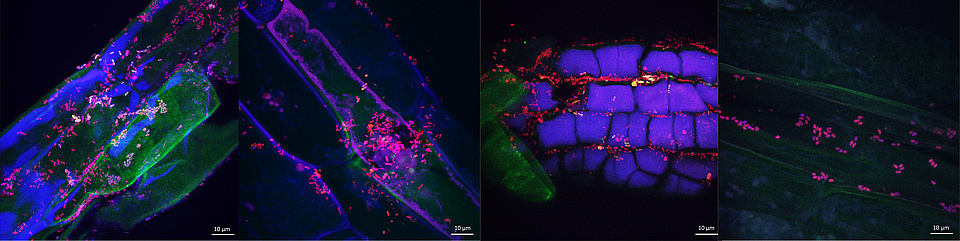 4 Microscope pictures of Gentiana asclepiadea