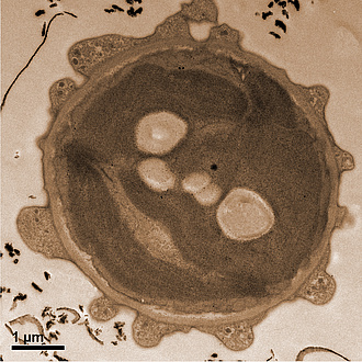 Image of a circular alga.