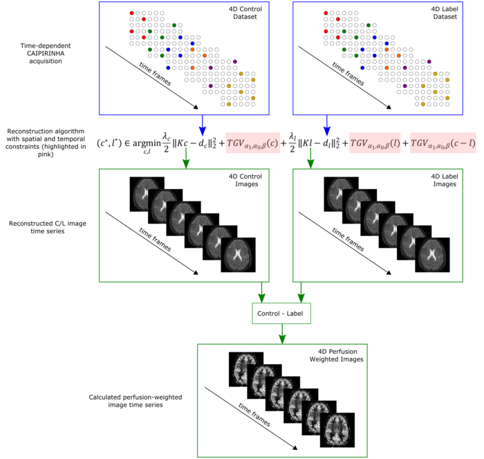 Five cubes are arranged in three rows. There are two cubes in the first row and it says Time-dependent CAIPIRINHA acquisition next to the first cube. The first cube shows a diagonal arrangement of 16 rows of six cubes. There are several white, red, blue, green, purple, orange and yellow dots Next to the dots, there is an downwards drawn arrow indicating the time frames. On the top right of the picture it says 4D Control Dataset. The second cube in the first row shows the same graphic, but it says 4D Label Dataset on the top right. There are two blue arrows pointing down from the first two cubes to an algorithm. Next to the algorithm is says Reconstruction algorithm with spatial and temporal constraints (highlighted in pink). The first cube in the second row shows six pictures of a brain. Again an arrow pointing downwards indicates time frames and it says 4D control Images on the top right. The second cube in the second row is the same as the first cube in the second row but says 4D Label Images in the top right. Next to the cubes is says Reconstructed C/L image time series. Two green arrows point downwards to a small cube that says Control – Label. The one cube in the third row shows six pictures of another brain. Again an arrow pointing downwards indicates time frames. It says 4D Perfusion Weighted Images on the top right. Next to the image it says Calculated perfusion-weighted image time series.