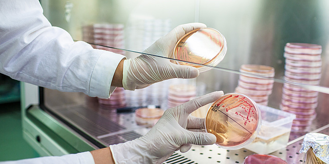 Microorganisms striked out on agar plates