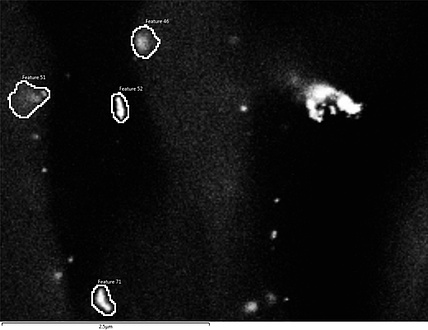 Eine Mikroskopaufnahme von goldmarkierten Nanopartikeln zeigt mehrere markierte vielzackige Strukturen, die durch umrandende Linien und Nummern hervorgehoben sind. Ein Maßstab von 2,5 Mikrometer ist unten eingeblendet.