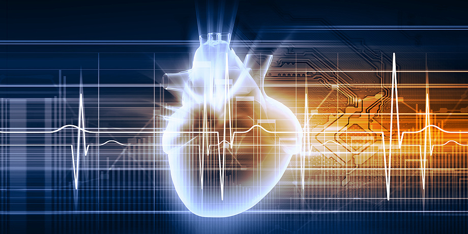 Grafik eines Herzens, im Hintergrund ist eine Herzstromkurve eines EKGs zu sehen.