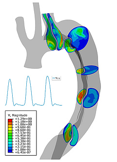 Grey graphic of an aorta, supplemented with blue-green-red colour dots