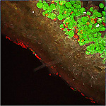 Lobaria pulmonaria, Inter-kingdom relationships in natural environments: Moss plant and lichen fragments with associated bacteria