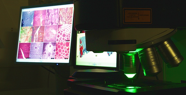 2 Bildschirme mit Mikroskopbildern, 1x Oberfläche, 1x 3D-Bild, im Vordergrund Objektivrevolver mit 4 Objektiven