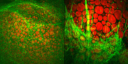 Visualization of brown and white adipose tissue.The lipid droplets were visualized with Coherent Anti-Stokes Raman Scattering microscopy.