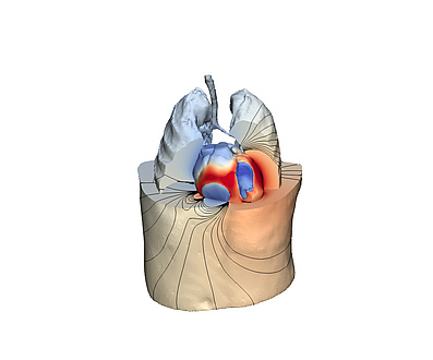 digital twin from a human heart