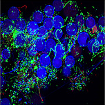 Haematococcus pluvialis, Microalgae-associated bacteria in natural and artificial environment