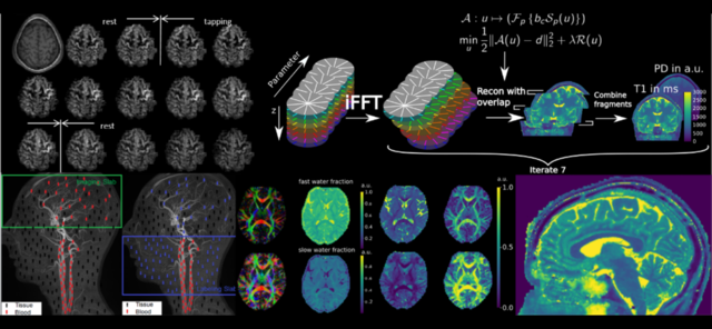 Biomarker Imaging